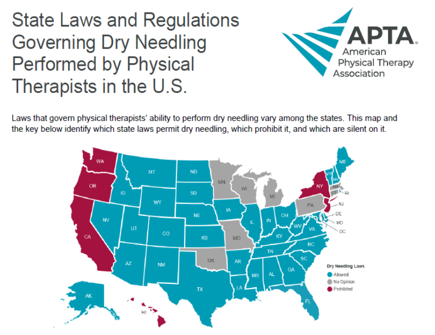 dry needling map