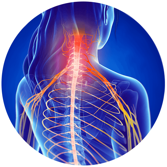 Treating Pinched Nerves Using Active Release Technique® - Nerve Pain